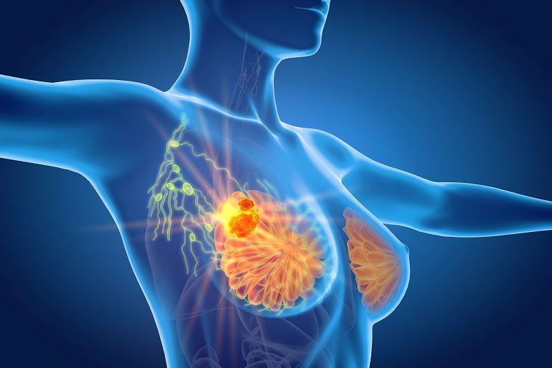 Laktacja a zgrubienia w piersiach