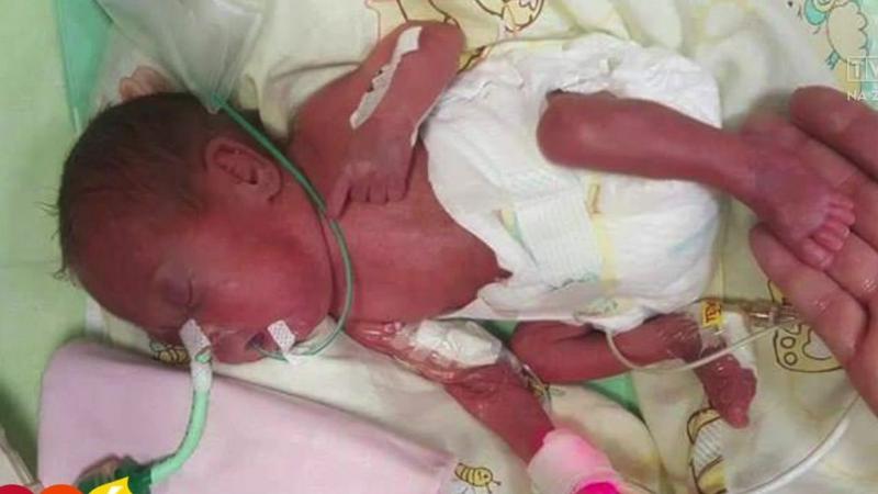 Rozwój płodu w 24 tygodniu ciąży