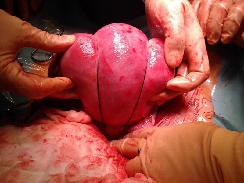 Krew po stosunku po porodzie – co powinnyśmy wiedzieć?